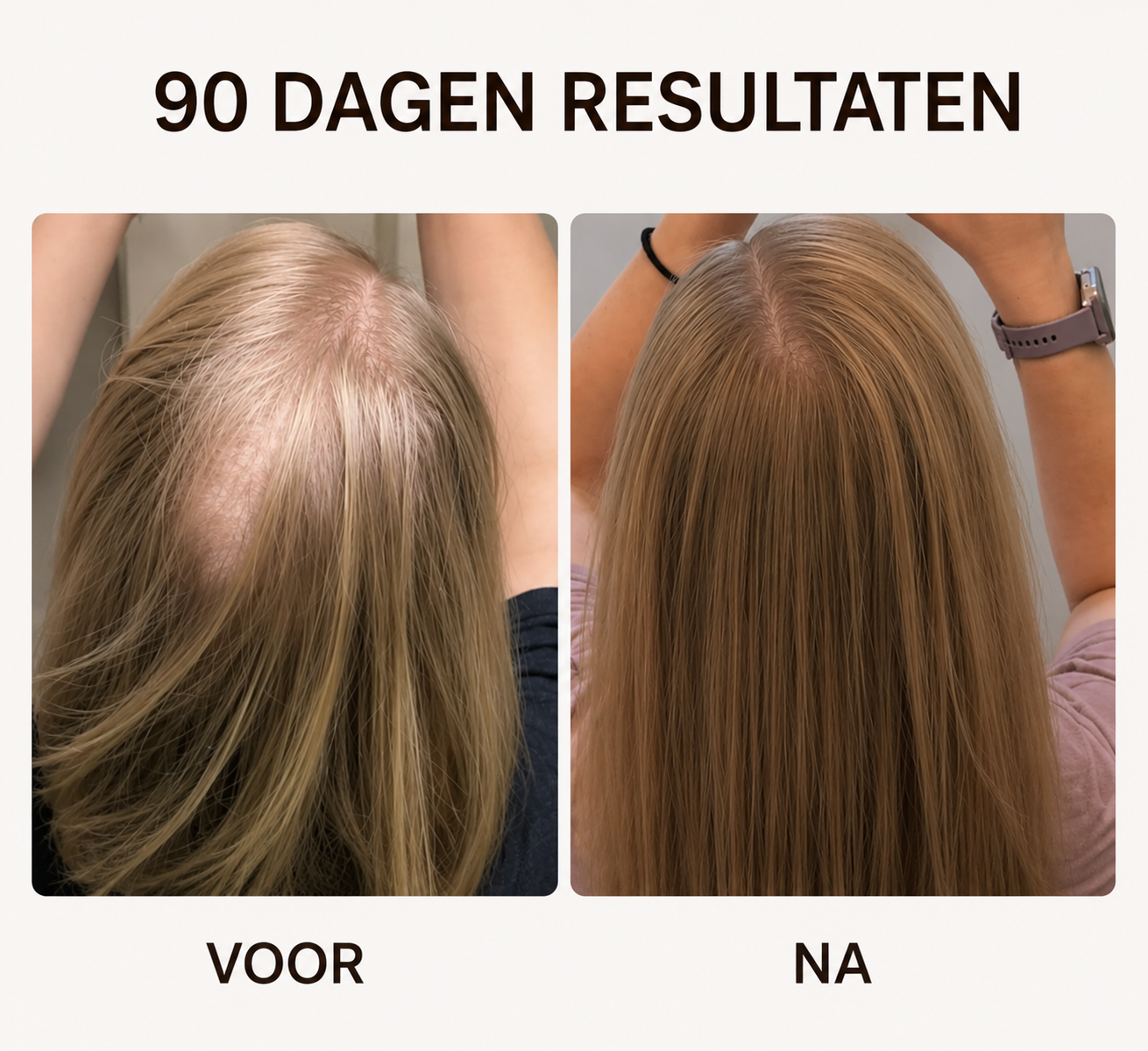 Roodlichttherapie Haarborstel - Krijg Voller Haar Met Slechts 10 Minuten Per Dag