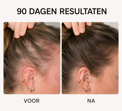 Roodlichttherapie Haarborstel - Krijg Voller Haar Met Slechts 10 Minuten Per Dag