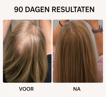 Roodlichttherapie Haarborstel - Krijg Voller Haar Met Slechts 10 Minuten Per Dag