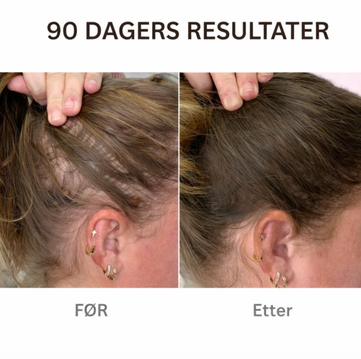 Rødt Lys Hårbørste - Få raskere hårvekst med bare 10 minutter om dagen