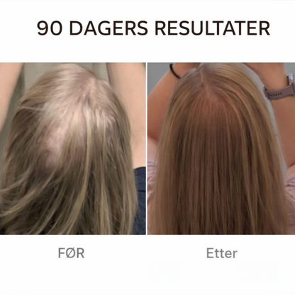 Rødt Lys Hårbørste - Få raskere hårvekst med bare 10 minutter om dagen